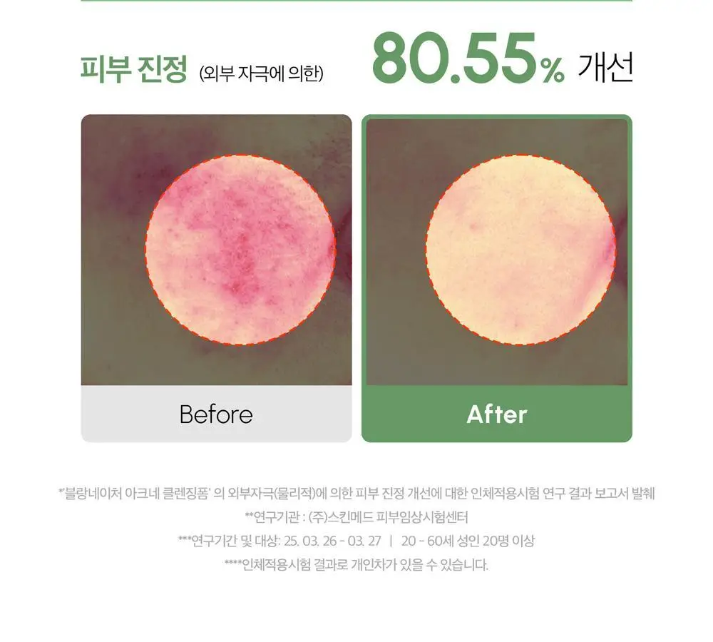 [여드름 기능성/피지케어] 블랑네이처 아크네 클렌징 폼 단품/기획 상세페이지 22